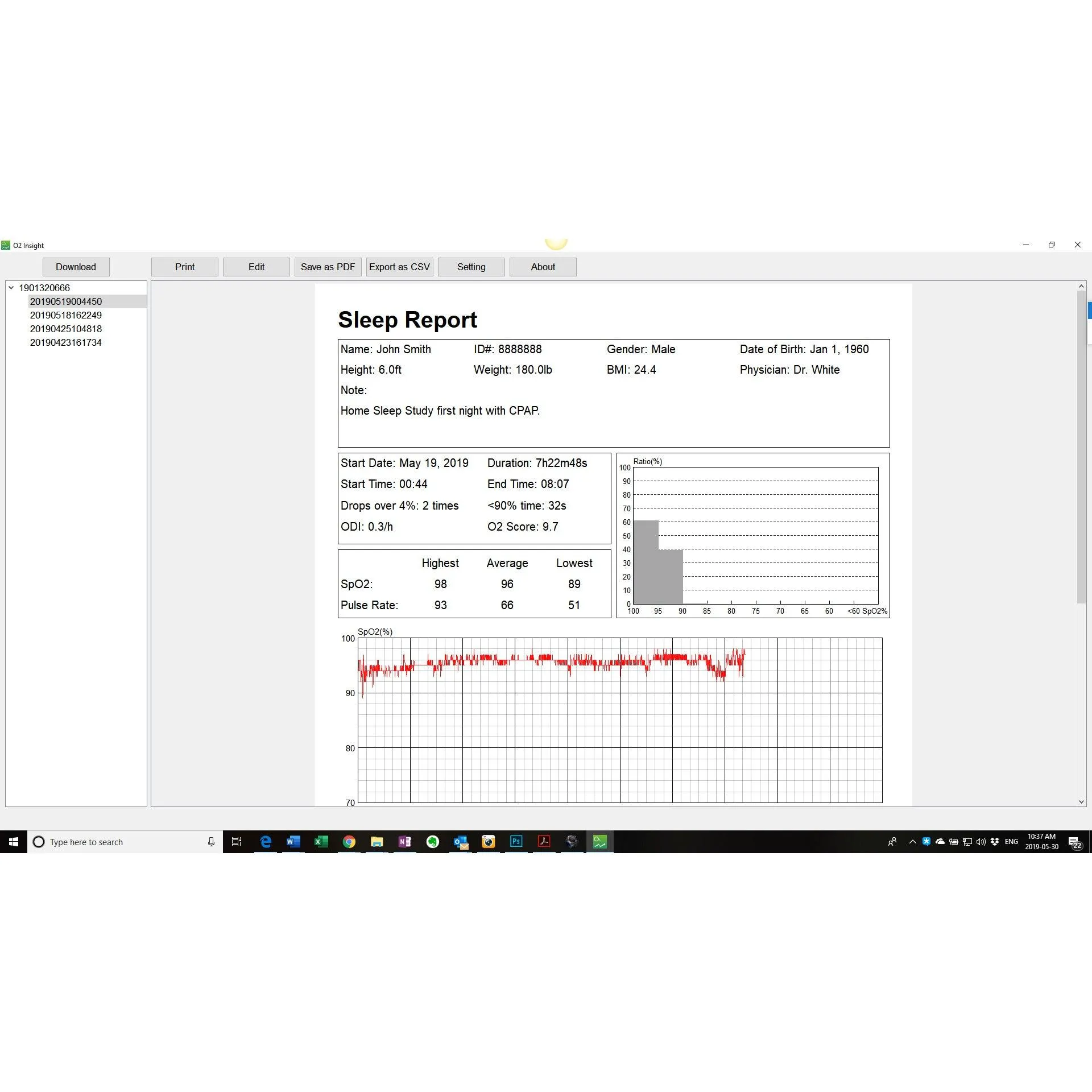 Professional Version Upgrade Package for LOOKEE® Ring Sleep Monitor, Including PC Software and PC Data Cable