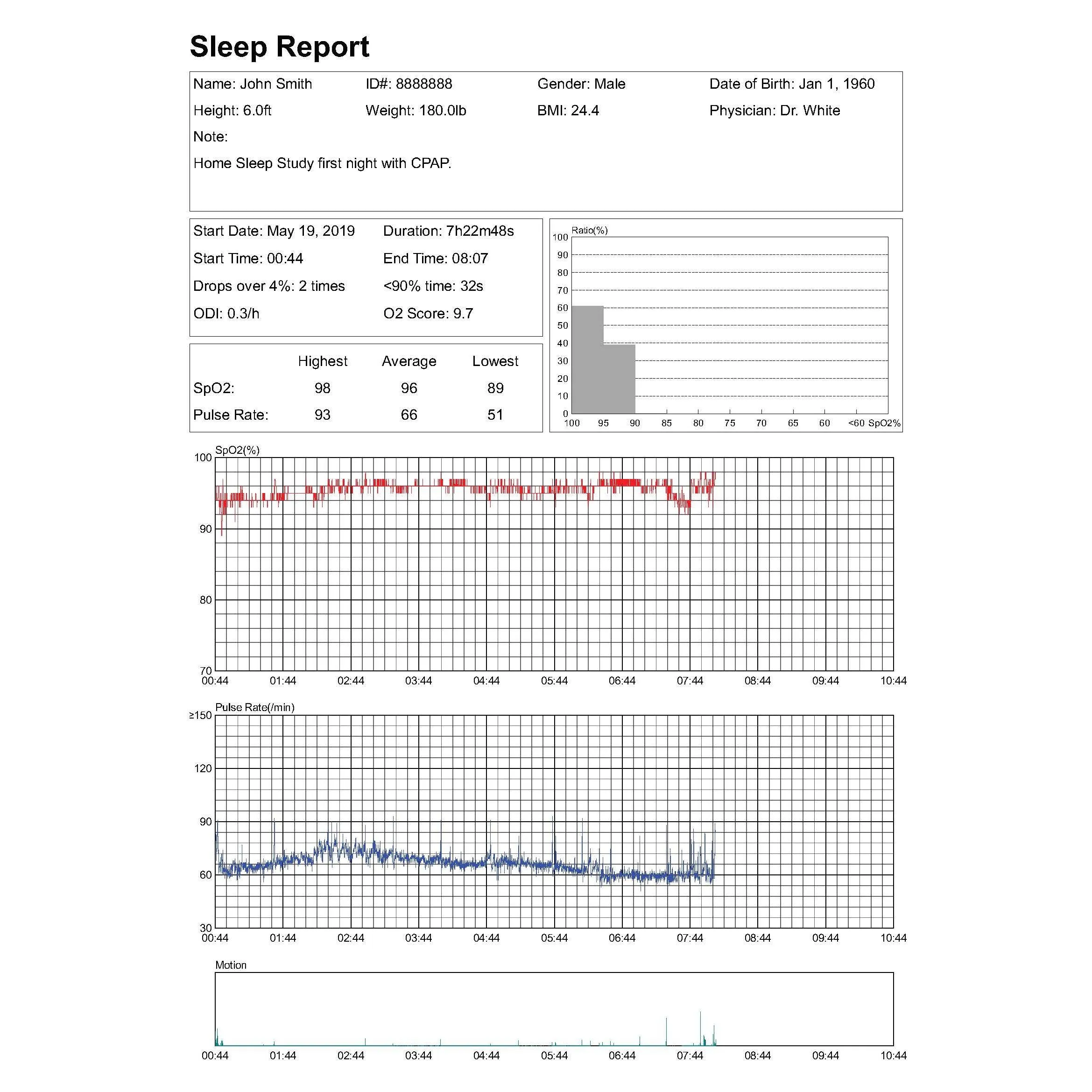 Professional Version Upgrade Package for LOOKEE® Ring Sleep Monitor, Including PC Software and PC Data Cable